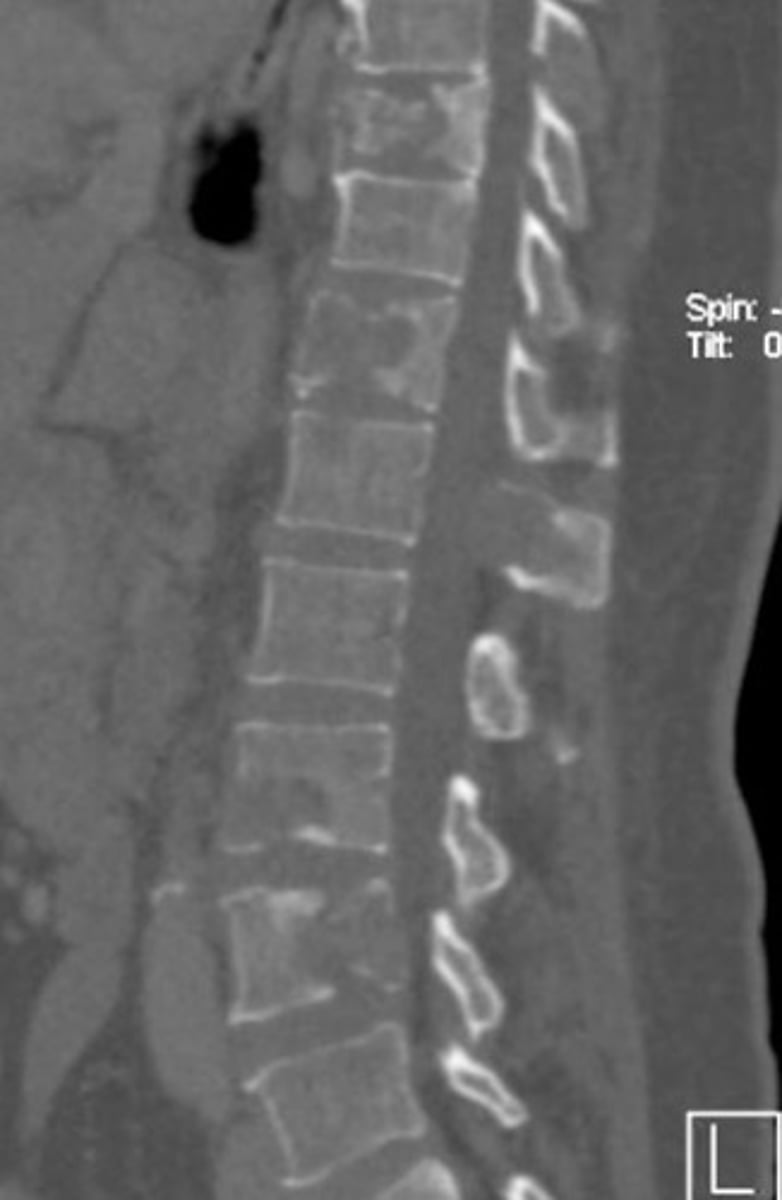 <p>What anomaly is this?</p>