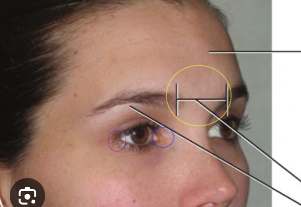 <p>What are the circles</p>