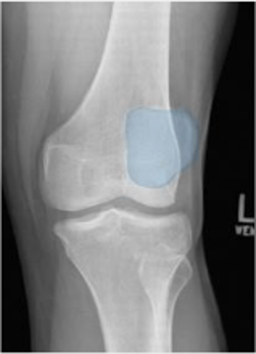 <p>What is outlined?</p>