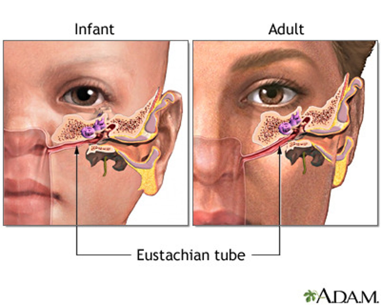 <p>their eustachian tubes are more horizontal, so it's easier for the infection to spread</p>