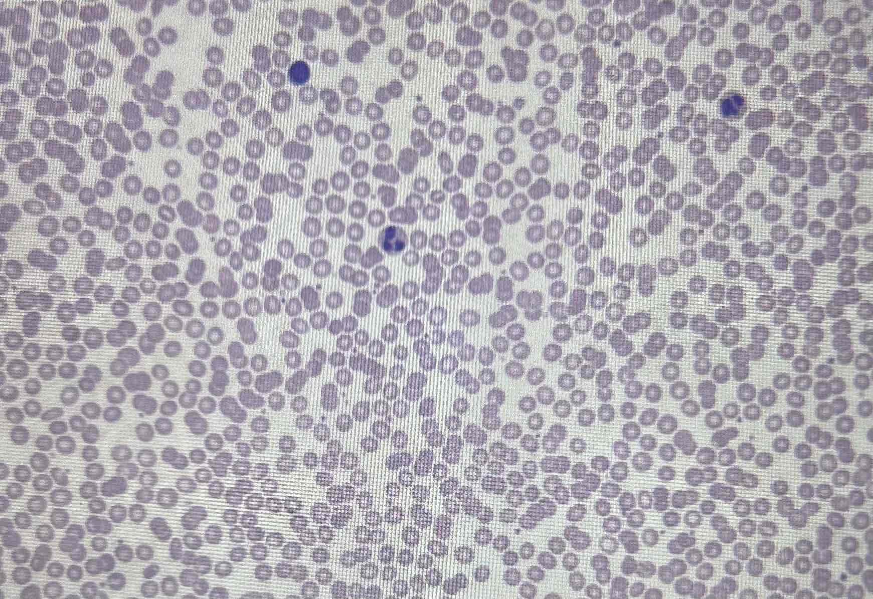 <p>Blood</p>