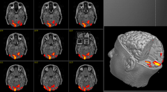 <p>cognitive neuroscience the interdisciplinary study of the brain activity linked with cognition (including perception, thinking, memory, and language).</p>