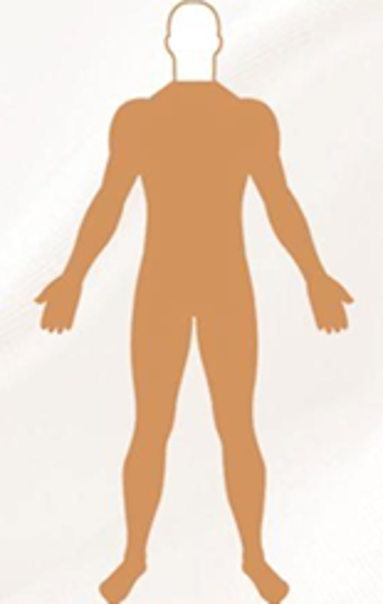 <p>all 4 limbs affected.</p><p>degenerative conditions (disk rupture) trauma, vascular, tumor</p>