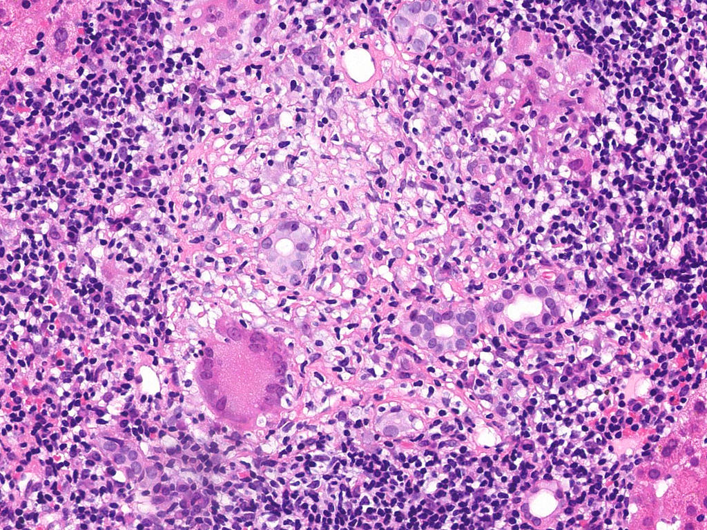 <p>What condition is shown?</p>