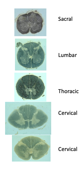 <p>W<strong>hy does the lumbar and cervical cross-sections of the spine have larger grey matter than the thoracic cross-section?</strong></p>