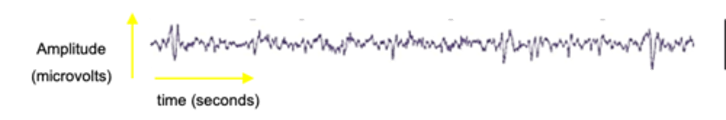 <p>What is Stage 4 of non-REM sleep?</p>
