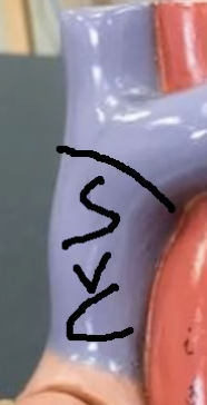 <p>What does this blue object represent…</p>