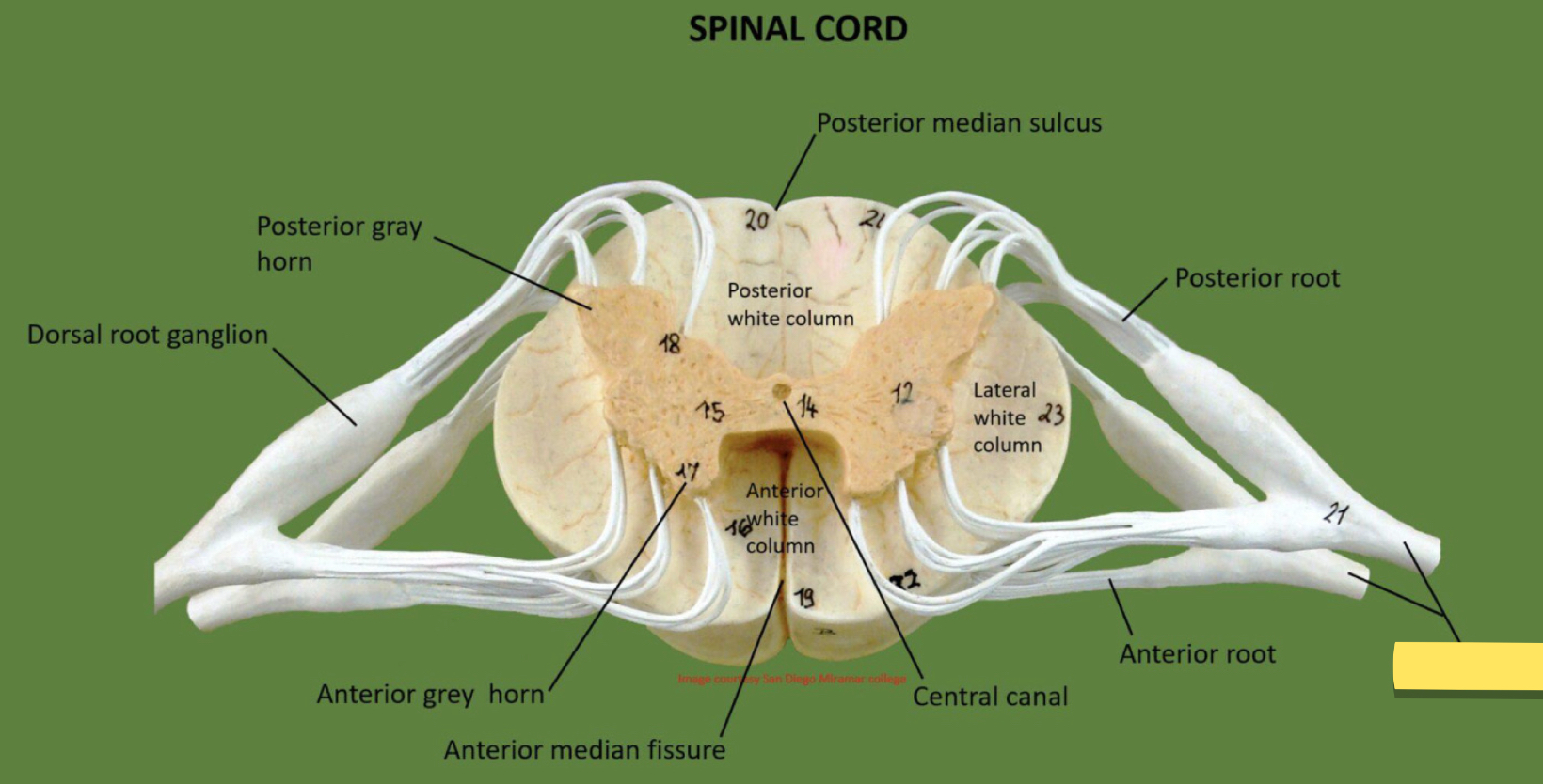 <p>Name this spinal cord part</p>