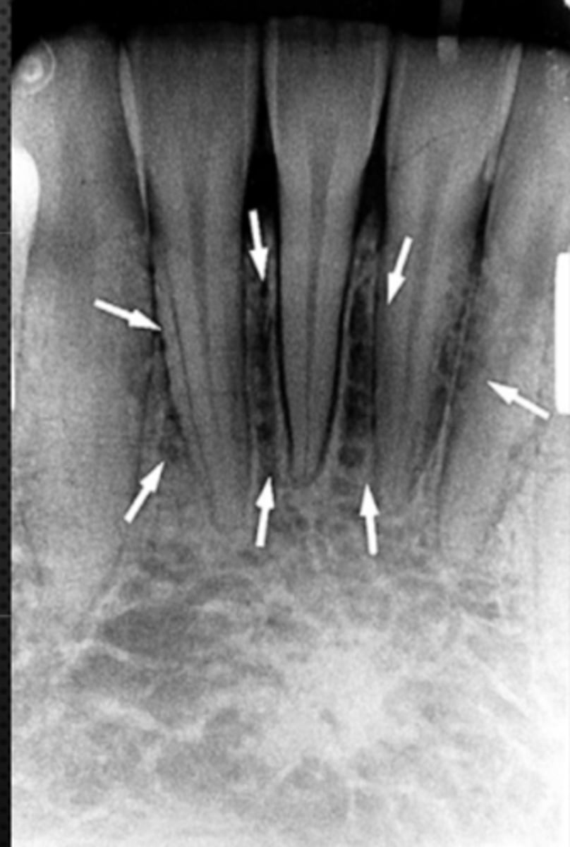 <p>Identify the structure</p>