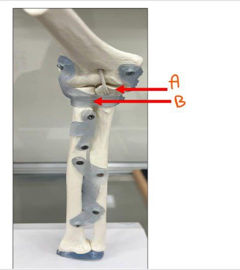 <p> Identify the joints in this picture and classify them </p>