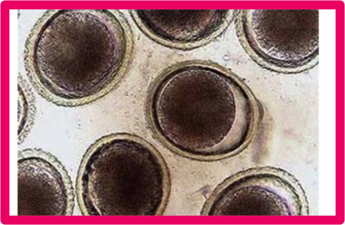 Ex. 
Toxocara canis
Tococara cati
Toxocara leonina
Baylisascaaris procyonis