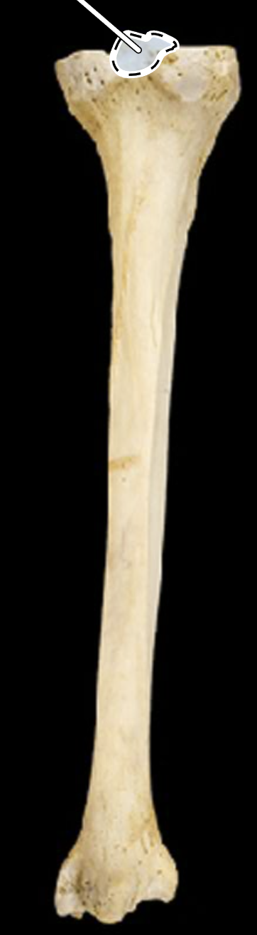 <p>Name the highlighted portion.</p><p>(Posterior view, right side).</p>