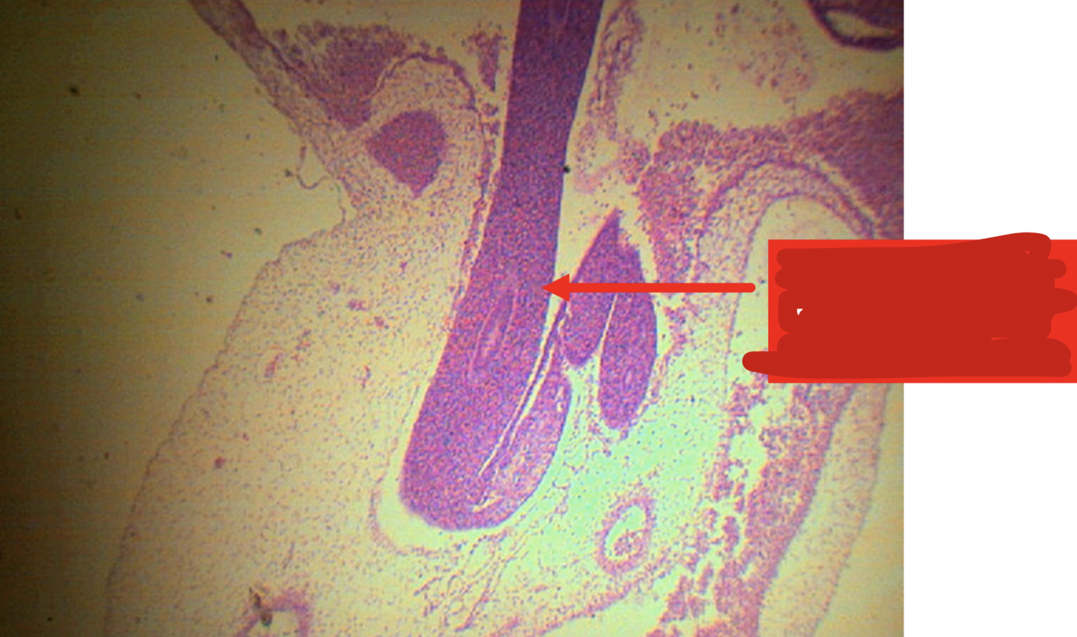 <p>Identify the structure; it returns back to the abdominal cavity at weeks _____</p>