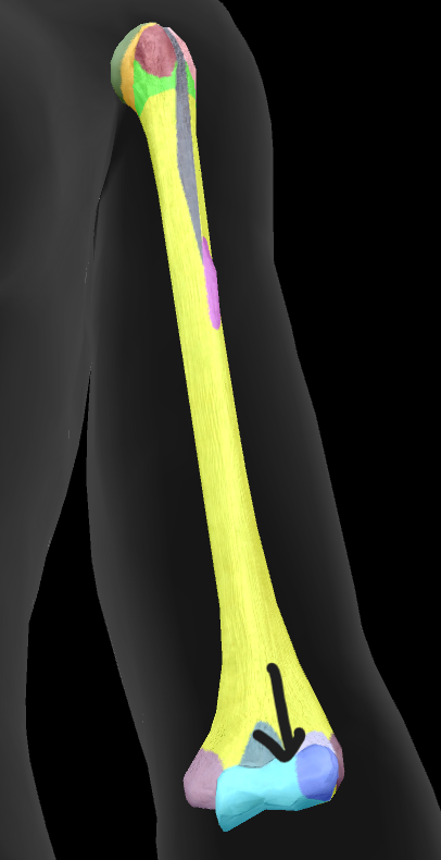 term image