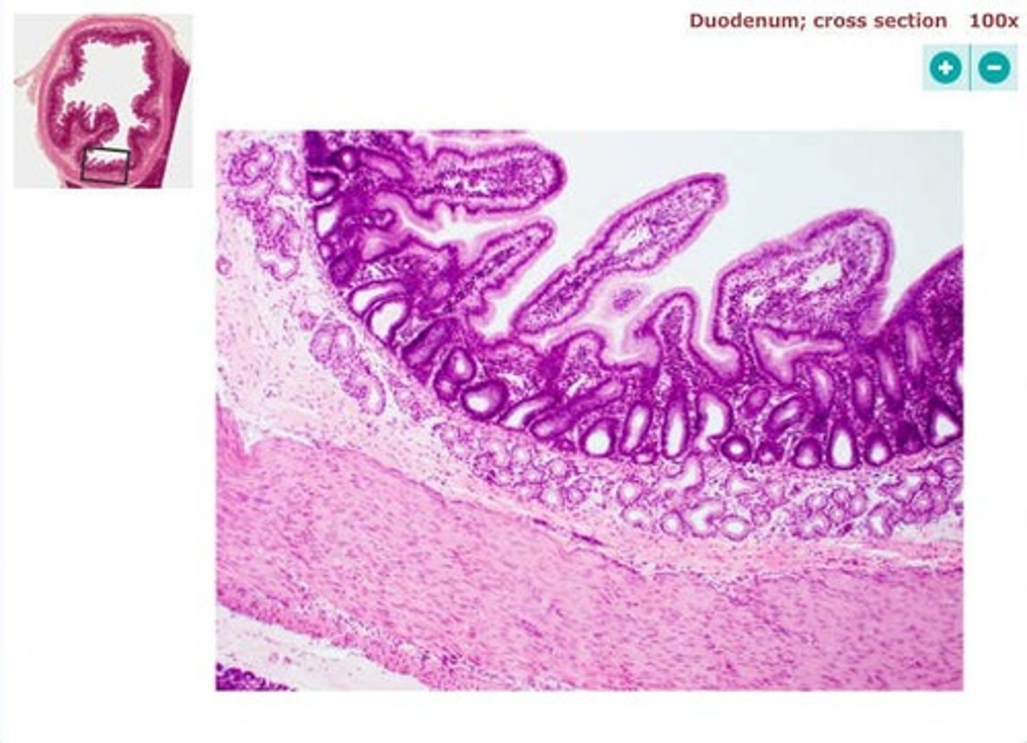 <p>simple columnar epithelium</p>