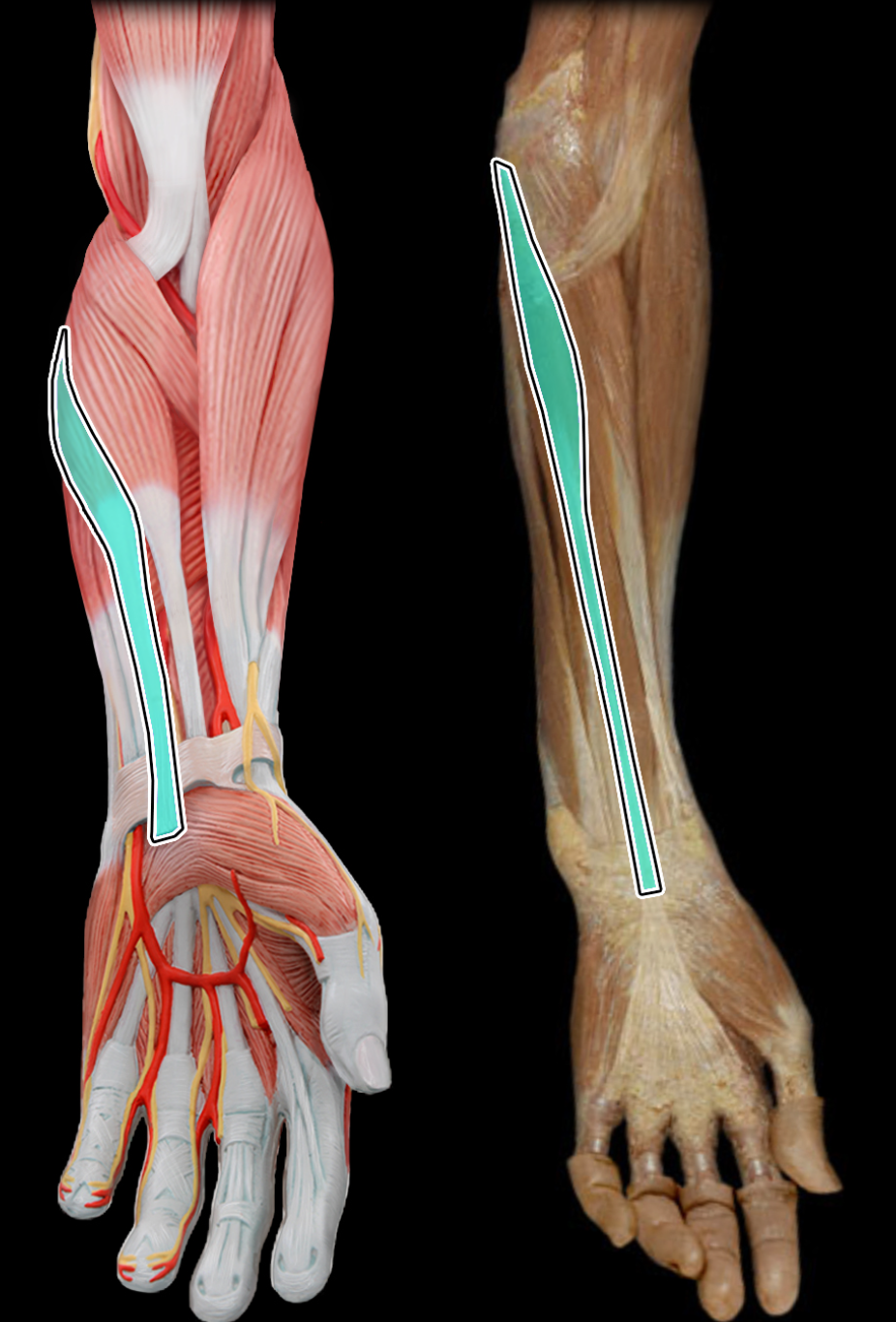 knowt flashcard image