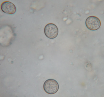 <p>Which parasite doe these oocysts belong to? How large are they and where are they found?</p>