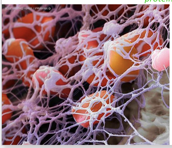 <ul><li><p><strong>Past</strong> <strong>prothrombinase</strong>, the <strong>pathway</strong> is the <strong>same</strong></p><ul><li><p>5. <strong>Prothrombinase</strong> converts <strong>Prothrombin</strong> into <strong>thrombin</strong></p></li><li><p>6. <strong>Thrombin</strong> converts <strong>fibrinogen</strong> into <strong>fibrin</strong></p></li><li><p>7. <strong>Fibrin</strong> forms a <strong>net</strong> <strong>like</strong> <strong>structure</strong> across the <strong>wound</strong>, which <strong>traps</strong> <strong>platelets</strong> and <strong>red blood</strong> <strong>cells</strong>, forming a <strong>clot</strong></p></li></ul></li></ul><p></p>