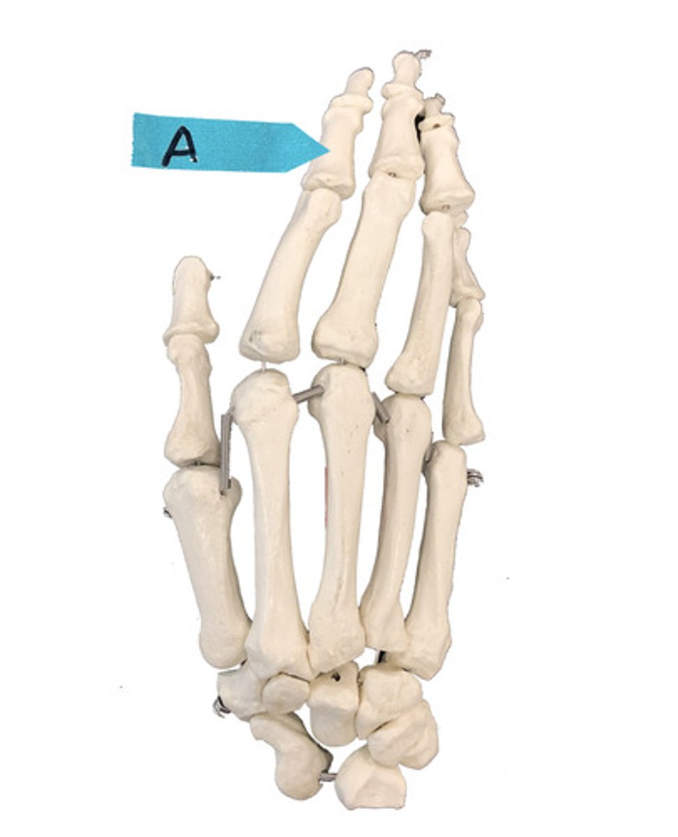 <p>Identify the bone (be specific).</p>
