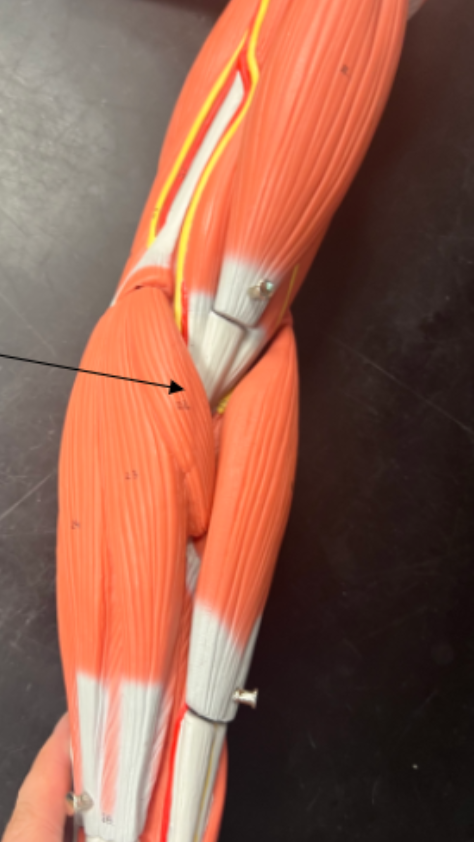 <p>what is this muscle?</p>