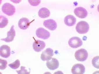 <p>DNA remants </p>