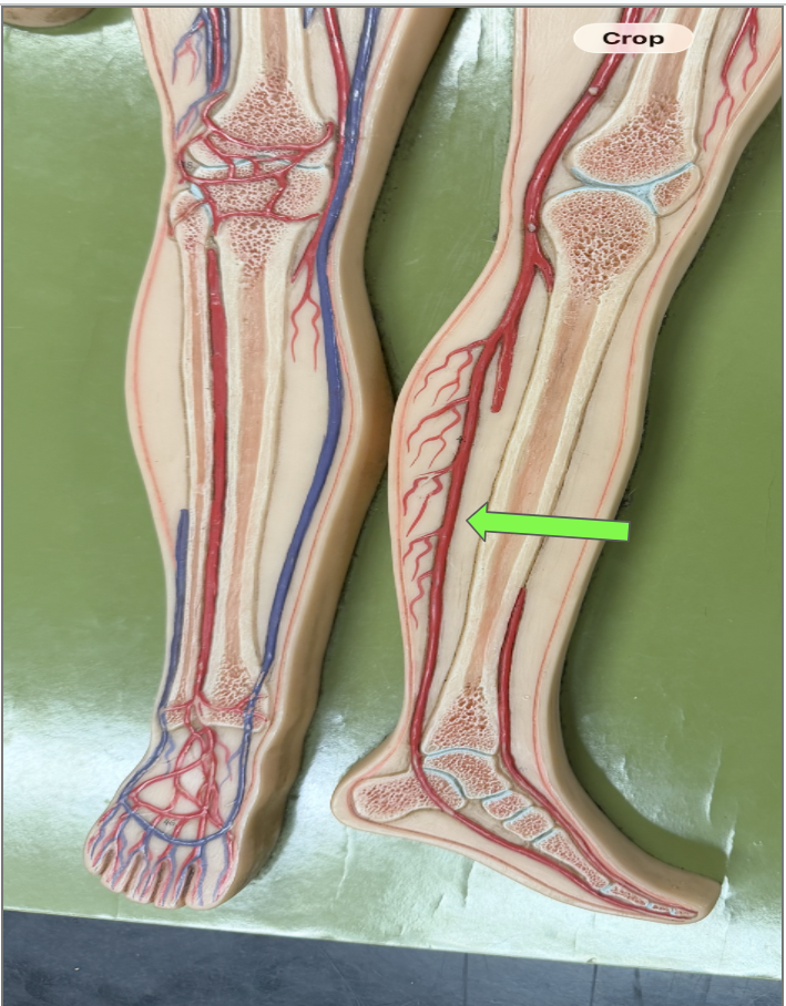 <p>What is this artery </p>