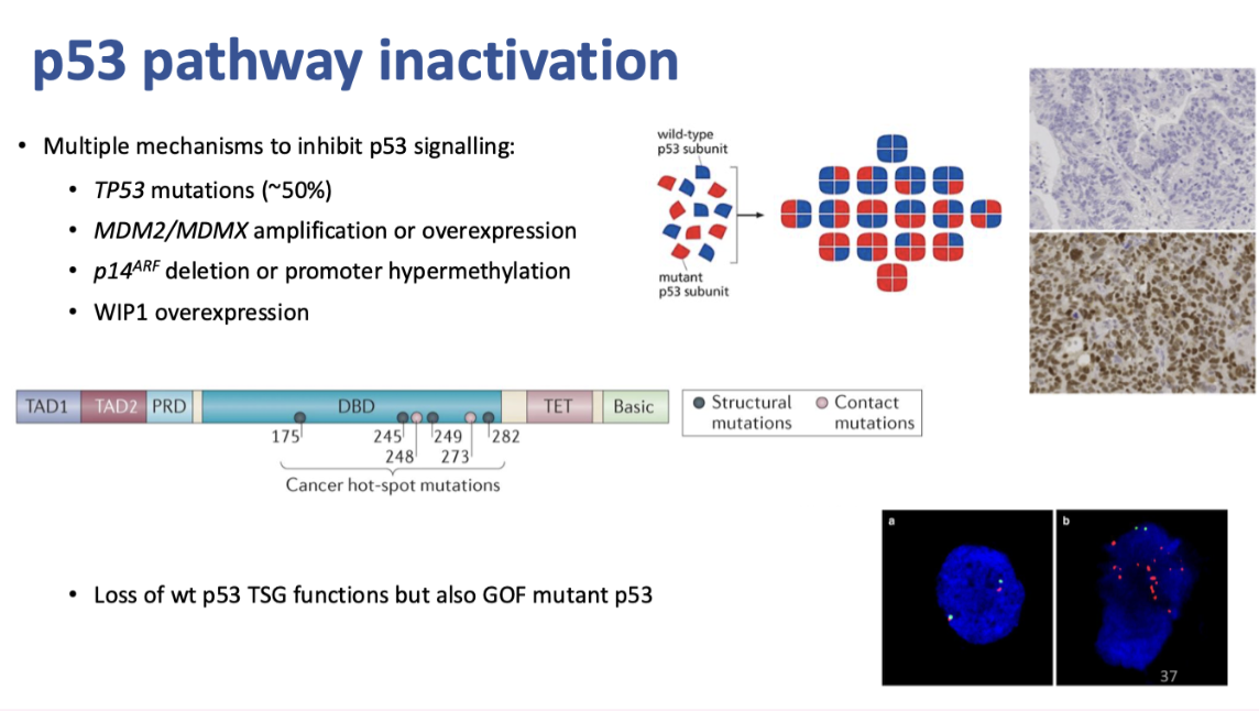 <ul><li><p><span style="background-color: inherit; line-height: 22px; color: windowtext;"><span>Hotspots normally in DNA binding domain of p53- between exons 5-8</span></span><span style="line-height: 22px; color: windowtext;"><span>&nbsp;</span></span></p></li><li><p><span style="background-color: inherit; line-height: 22px; color: windowtext;"><span>P53 acts as tetramer- has a dominant negative effect</span></span><span style="line-height: 22px; color: windowtext;"><span>&nbsp;</span></span></p></li></ul><p class="Paragraph SCXO187836289 BCX0" style="text-align: left;"><span style="background-color: inherit; line-height: 22px; color: windowtext;"><span>Accumulation of p53 indicates a mutation that increases its half life as mdm2 doesn’t negatively regulate it&nbsp;</span></span><span style="line-height: 22px; color: windowtext;"><span>&nbsp;</span></span></p>