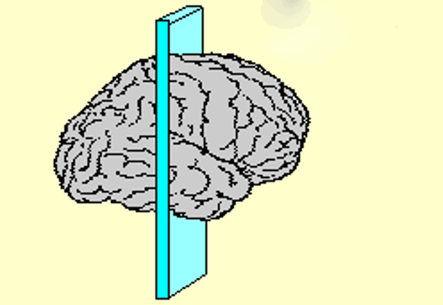 <p>This image depicts what kind of brain section?</p>