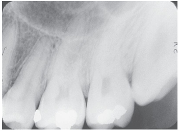 <p>What is the problem with this Bending X-ray?</p>