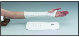 <p><strong>Function:</strong></p><ul><li><p>Maintain the wrist in a neutral or mildly extended position.</p></li><li><p>Immobilizes the wrist while allowing full MCP flexion and thumb mobility. </p></li></ul><p><strong>Examples:</strong></p><ul><li><p>Wrist cock-up splint (image)</p></li><li><p>Dorsal wrist cock-up splint</p></li></ul><p></p>