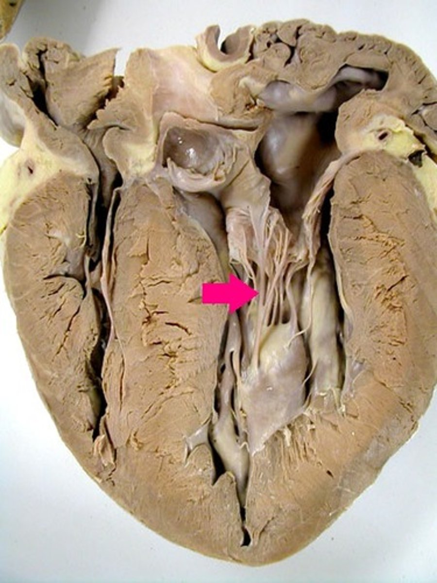 <p>Identify the strands.</p>