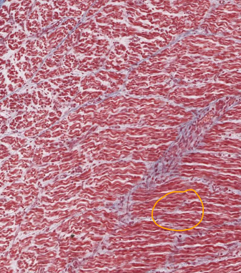 <ol start="14"><li><p>Identify this tissue</p></li></ol><p></p>