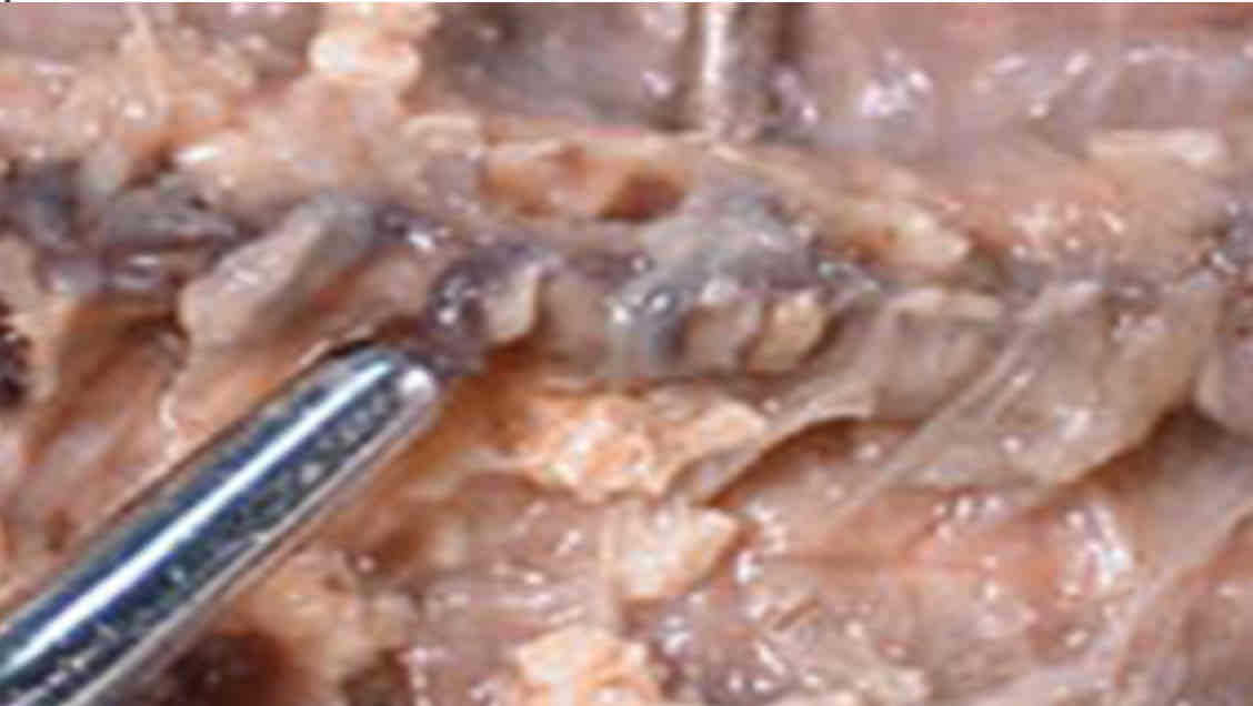 <p>Identify this structure</p>