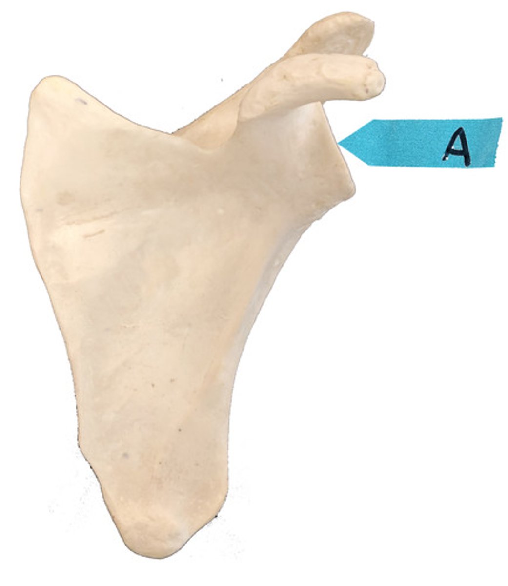 <p>Identify this bone marking.</p>