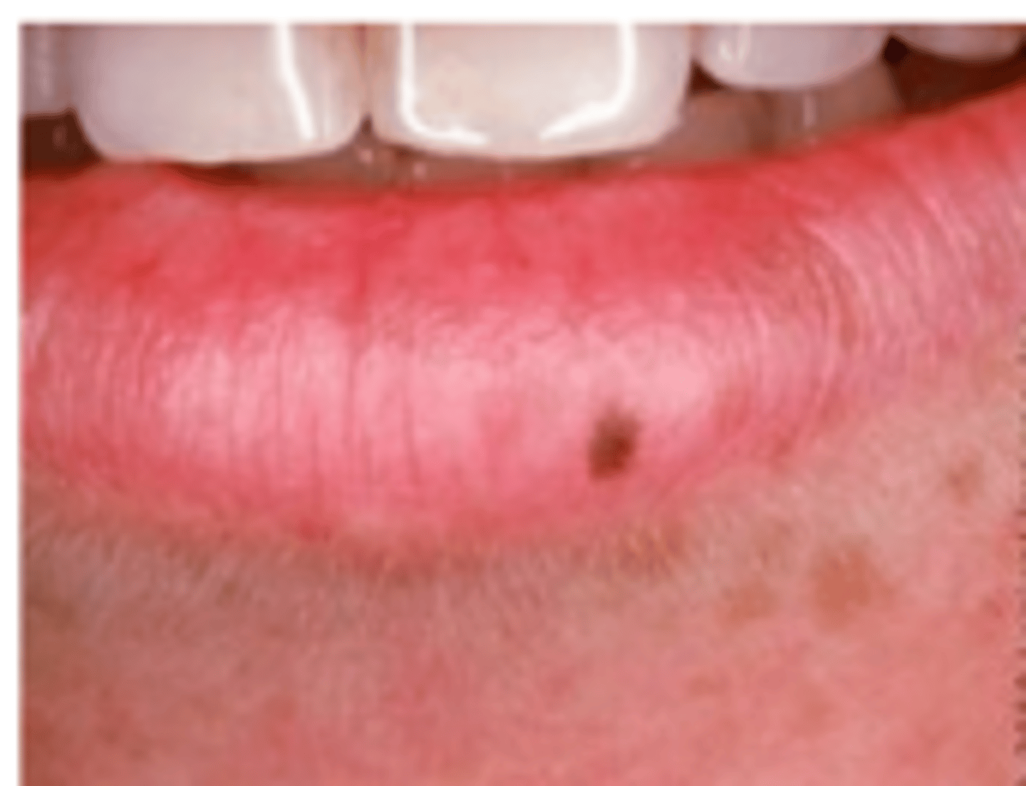 <p>Macule</p>