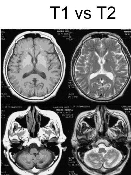 <p>Now describe MRI. The principle/key concepts/clinical rel/limits. </p>