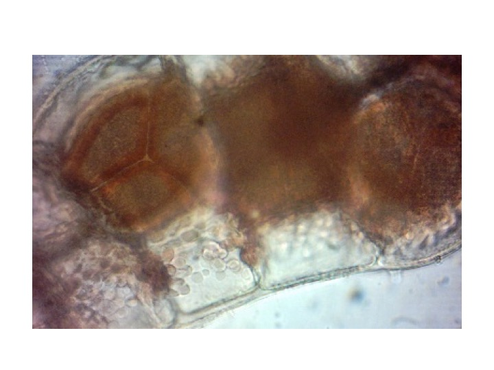 <p>What type of reproductive structure is visible on this slide?</p><p>Tetraspore</p><p>Carpogonia</p><p>Carpospore</p><p>Spermatia</p><p></p>