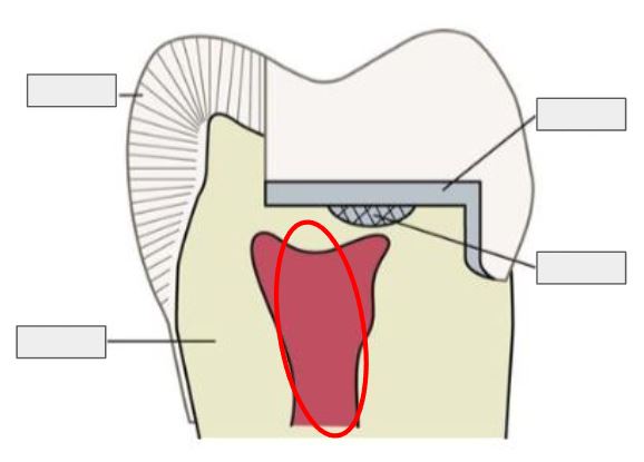<p>What is Pulp?</p>