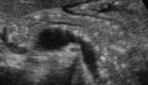 <p>Describe this image</p><p>Diagnosis?</p>