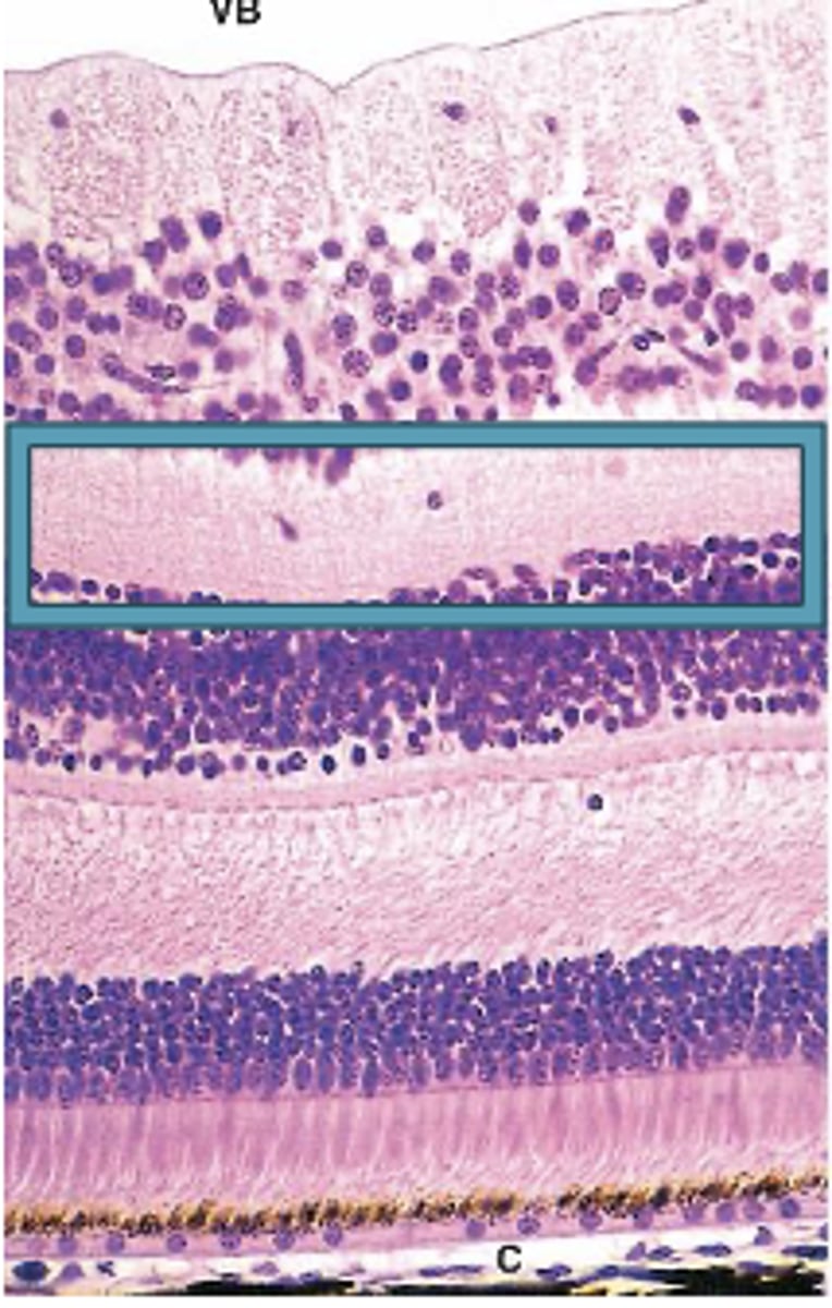 <p>Identify the Layers of the neural retina</p>
