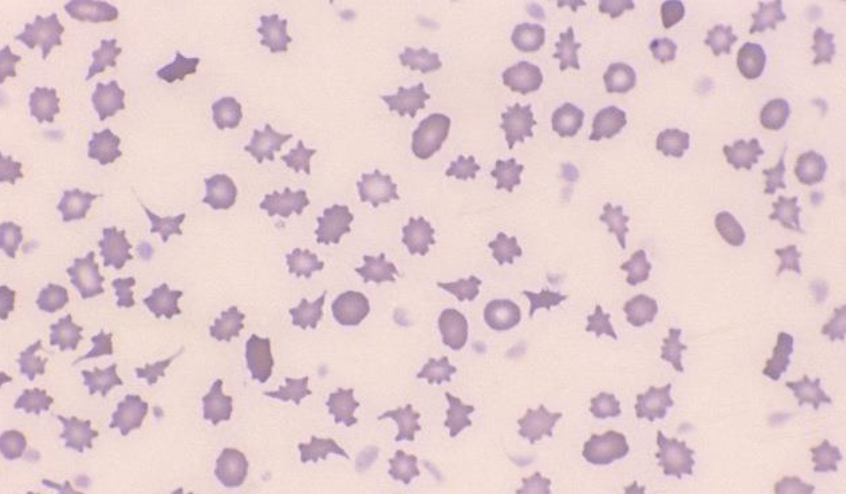 Name this RBC Abnormality.