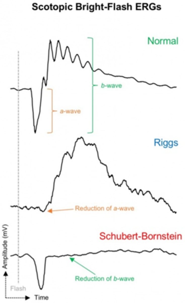 <p>scotopic ERG will be abnormal</p>