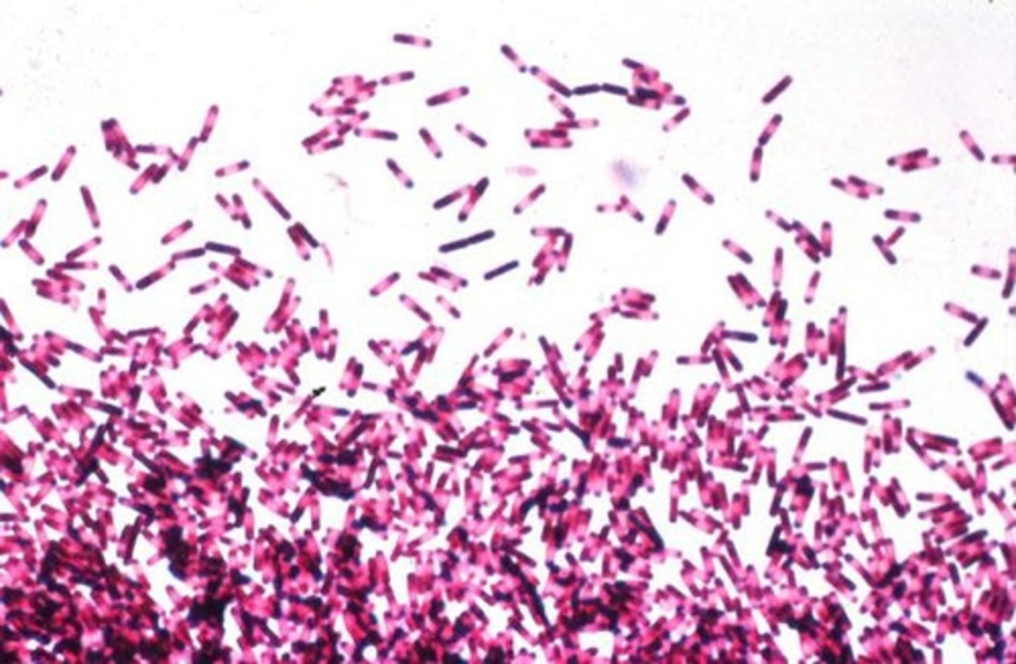 <p>A bacterium that reproduces every 20 minutes.</p>