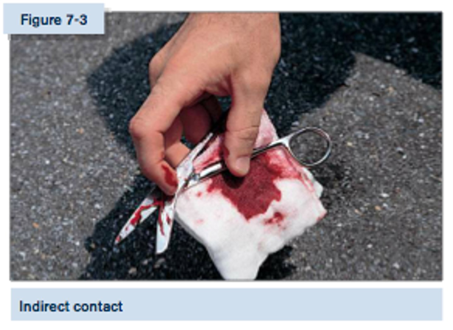 <p>transmission of blood or body fluids through contact with an intermediate contaminated object, such as a razor, extractor, nipper, or an environmental surface</p>