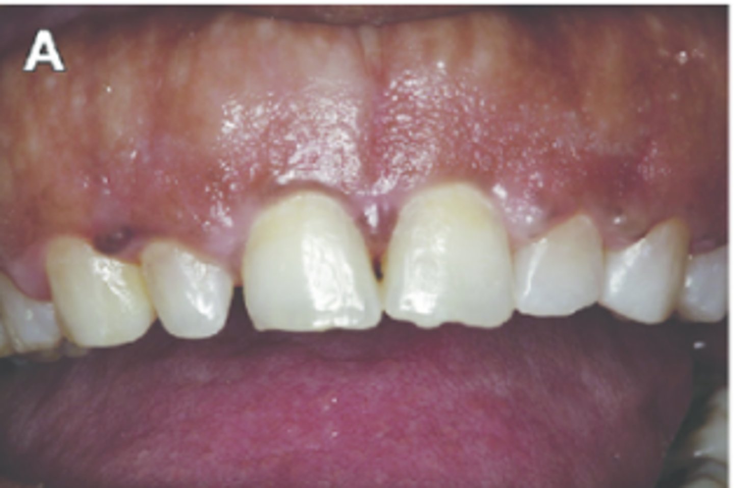 <p>what biotype is this and why?</p>