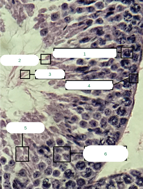 <p>What is the structure in 5?</p>