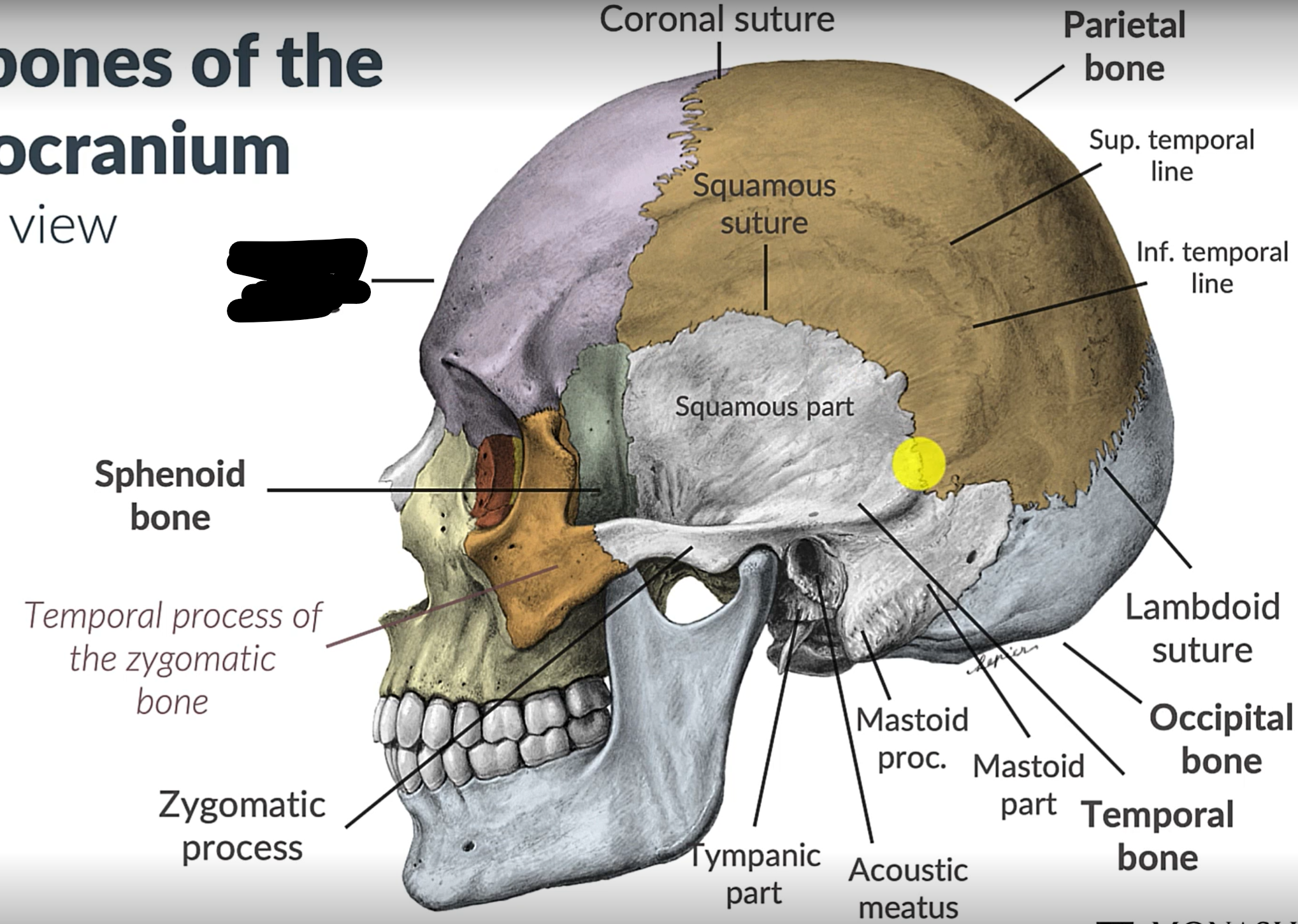 term image