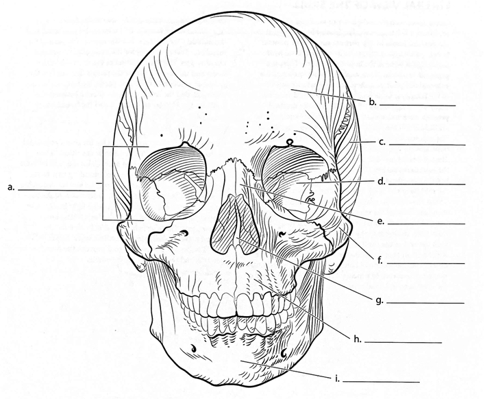 <p>ID → Sphenoid Bone</p>