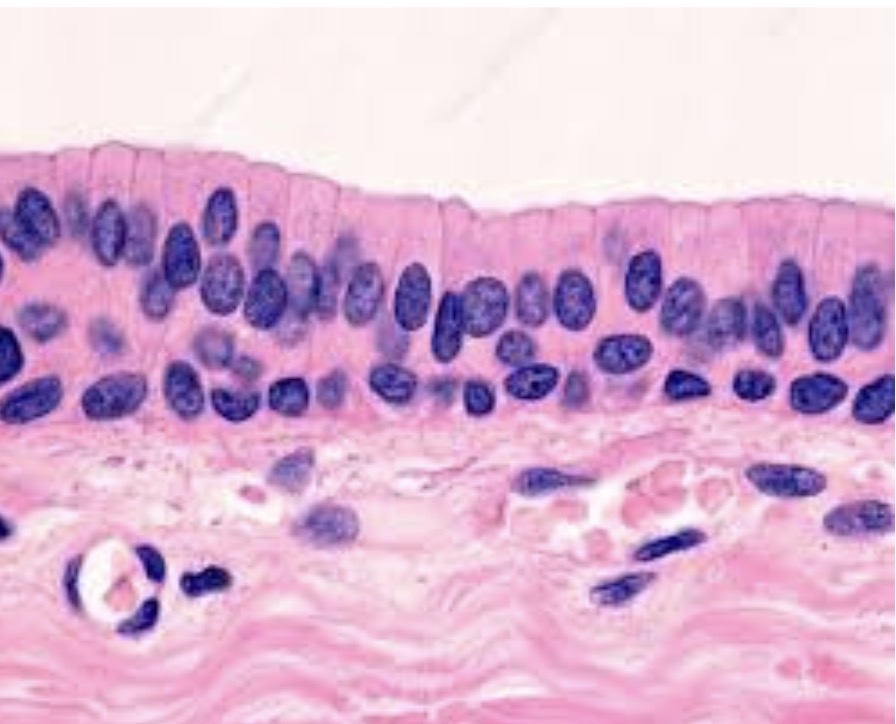 <p>what type?</p>