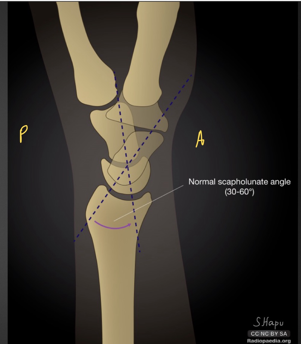 <p>what is this measurement and what is considered normal </p>